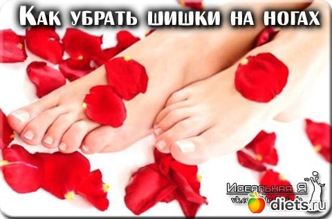 Как избавиться от косточки на ноге в домашних условиях